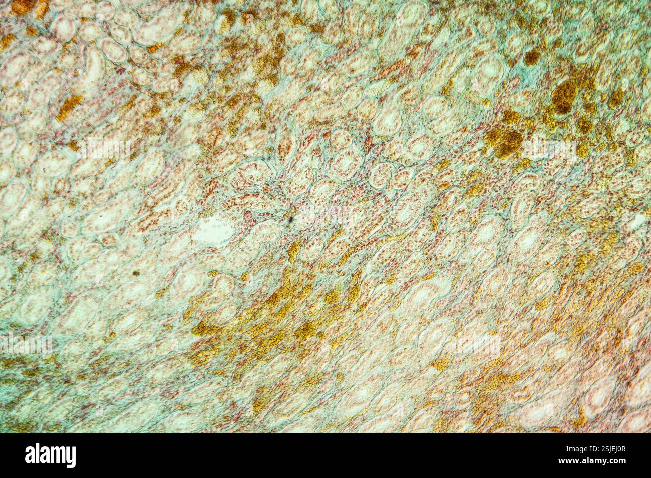 Ictère tissu malade 100x Banque D'Images