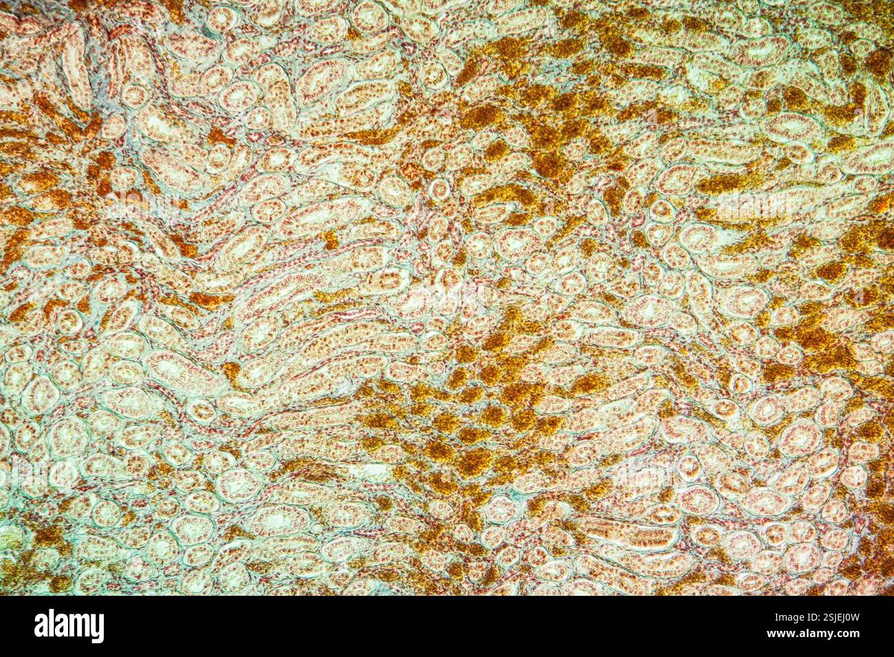 Ictère tissu malade 100x Banque D'Images