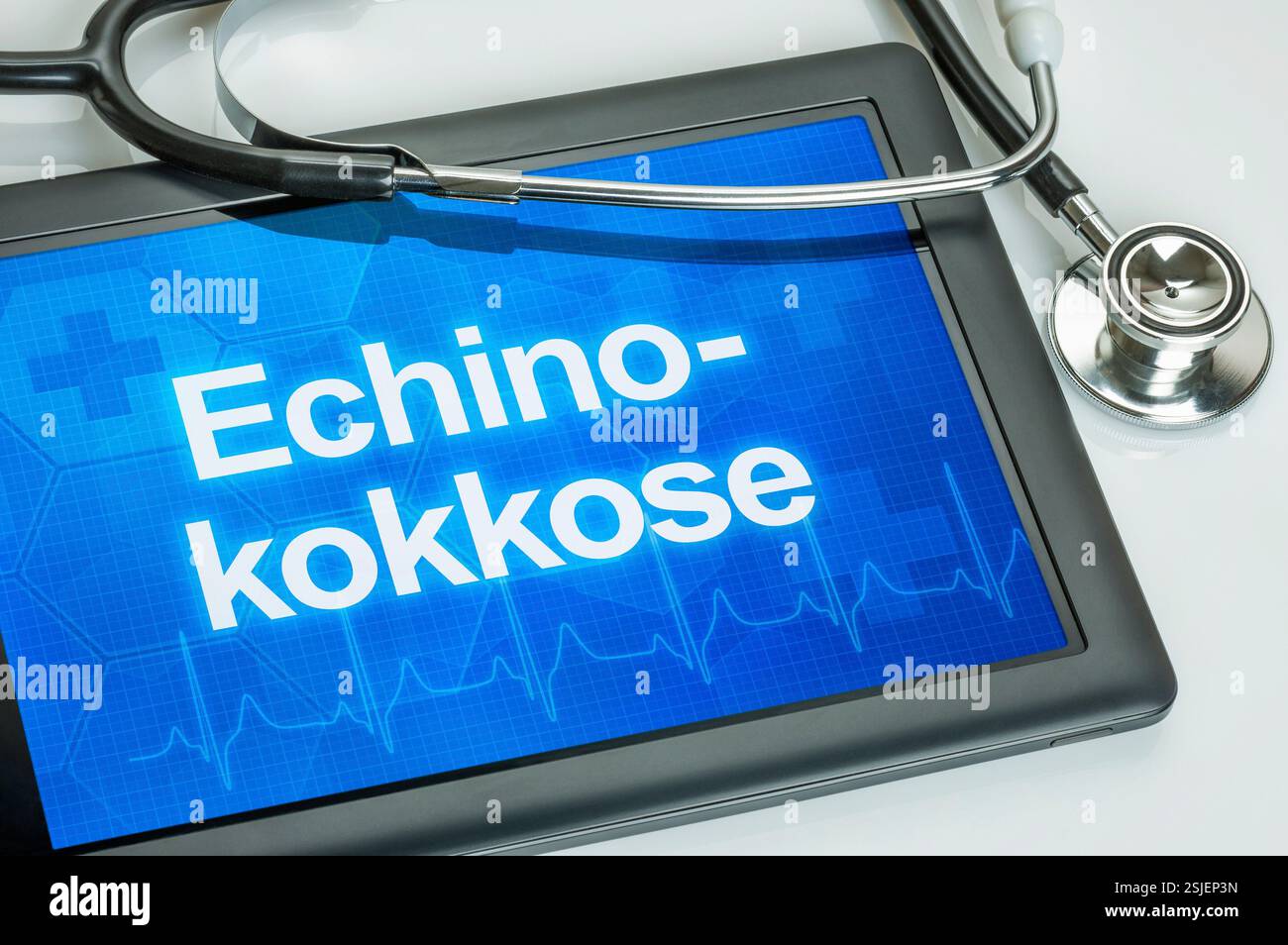 Comprimé avec le diagnostic de l'échinococcose sur l'écran Banque D'Images