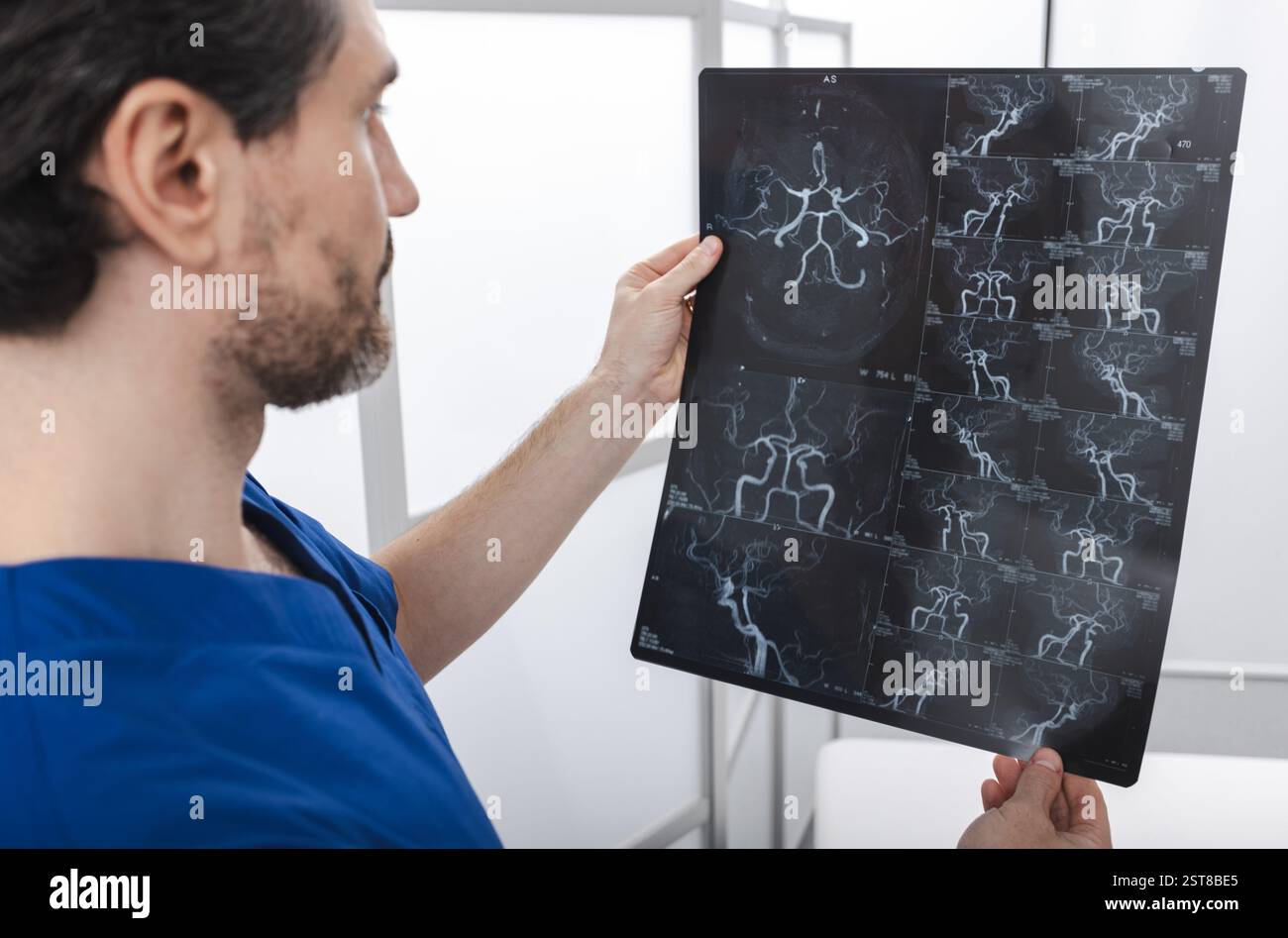 Neurologue examinant l'image cérébrovasculaire IRM du cerveau lors d'une consultation médicale pour un patient souffrant de maux de tête et de vertiges. Résonance magnétique an Banque D'Images