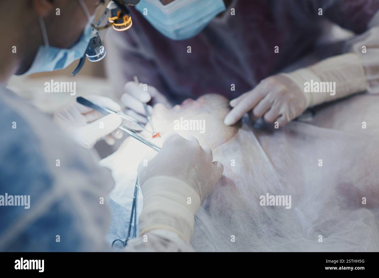 Les chirurgiens se concentrent sur une intervention faciale en salle d'opération stérile Banque D'Images