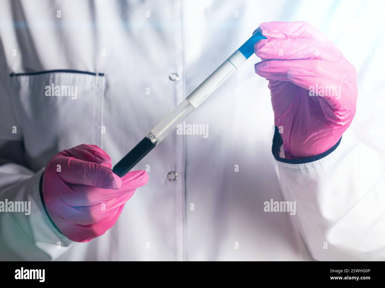 Un médecin reproducteur tient un récipient stérile avec du sperme et des ovules dans ses mains. Insémination artificielle Cotsnept, éco. Infertilité du patient, gros plan Banque D'Images