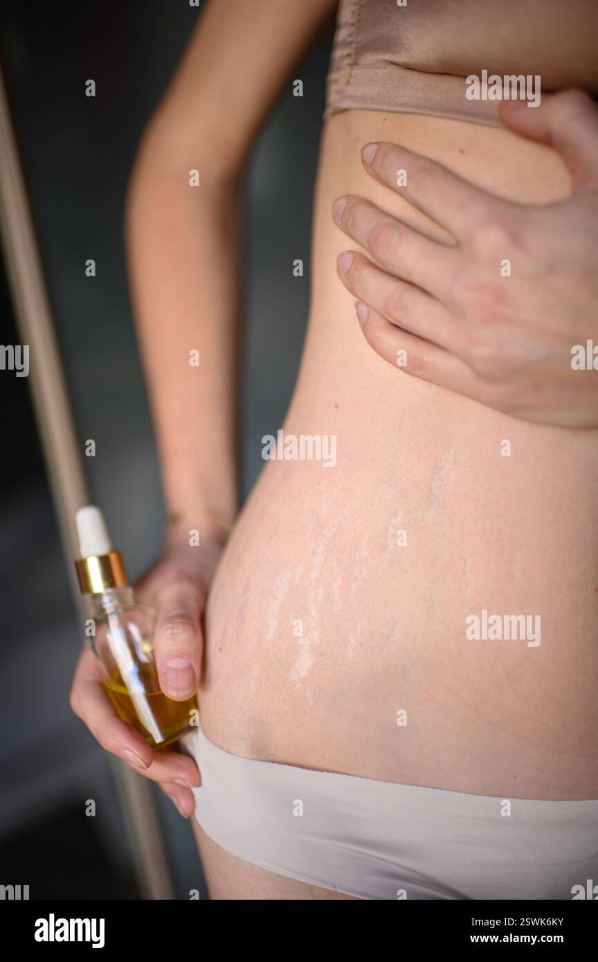 Une femme applique de l'huile sur son ventre avec des vergetures, massant doucement sa peau dans un rituel de soins personnels qui embrasse la beauté naturelle et l'amour de soi. Banque D'Images