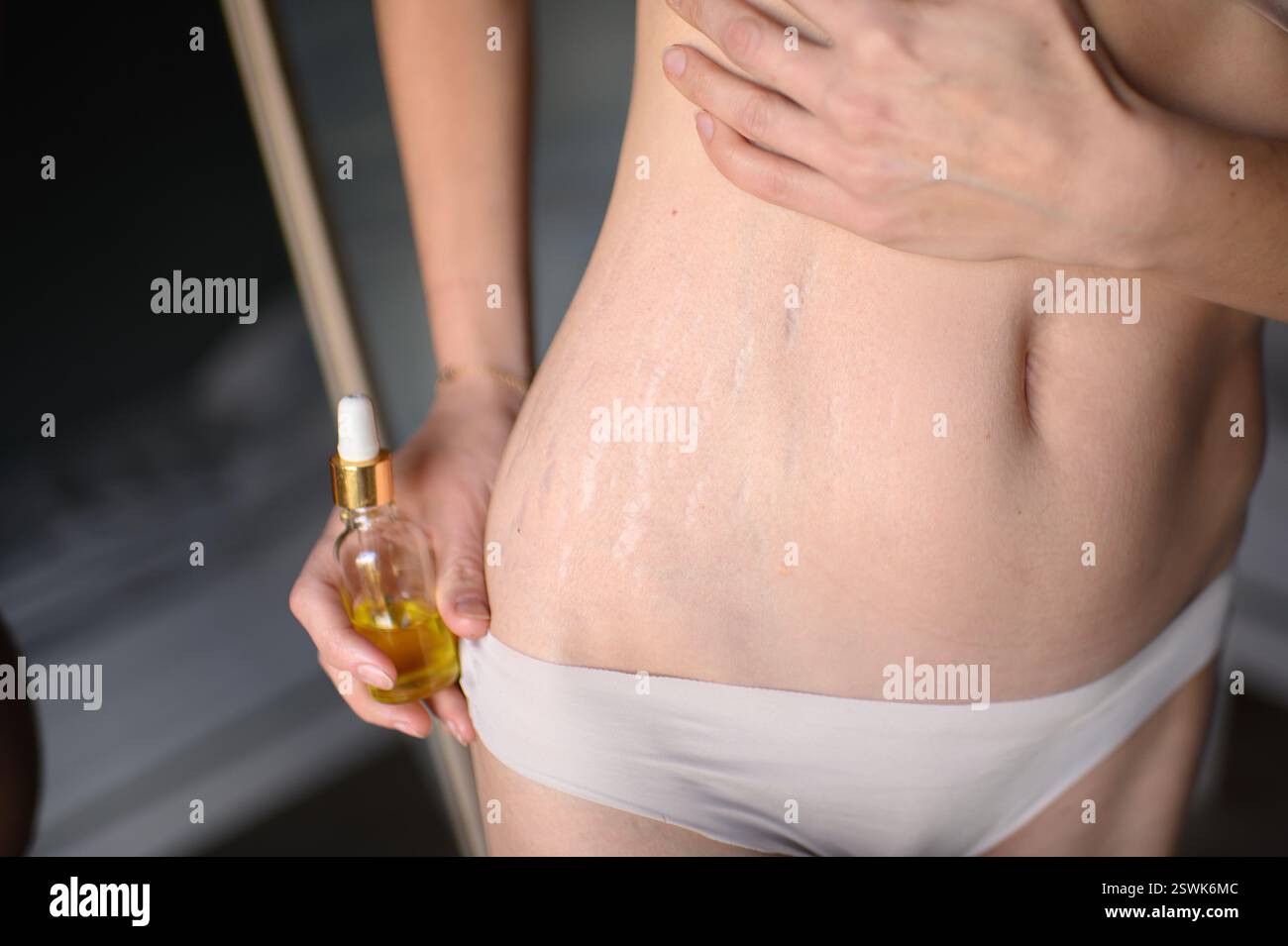 Une femme applique de l'huile sur son ventre avec des vergetures, massant doucement sa peau dans un rituel de soins personnels qui embrasse la beauté naturelle et l'amour de soi. Banque D'Images