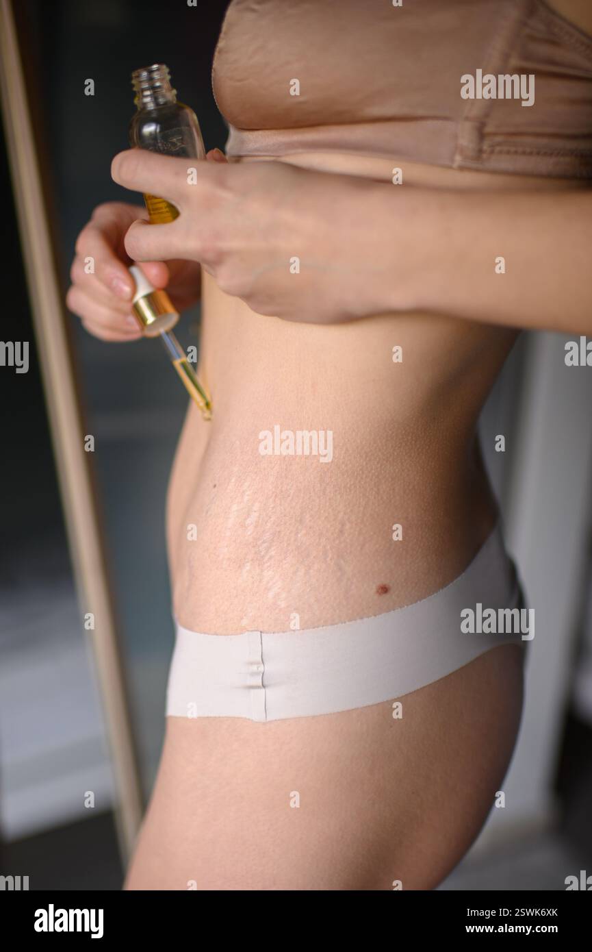 Une femme applique de l'huile sur son ventre avec des vergetures, massant doucement sa peau dans un rituel de soins personnels qui embrasse la beauté naturelle et l'amour de soi. Banque D'Images