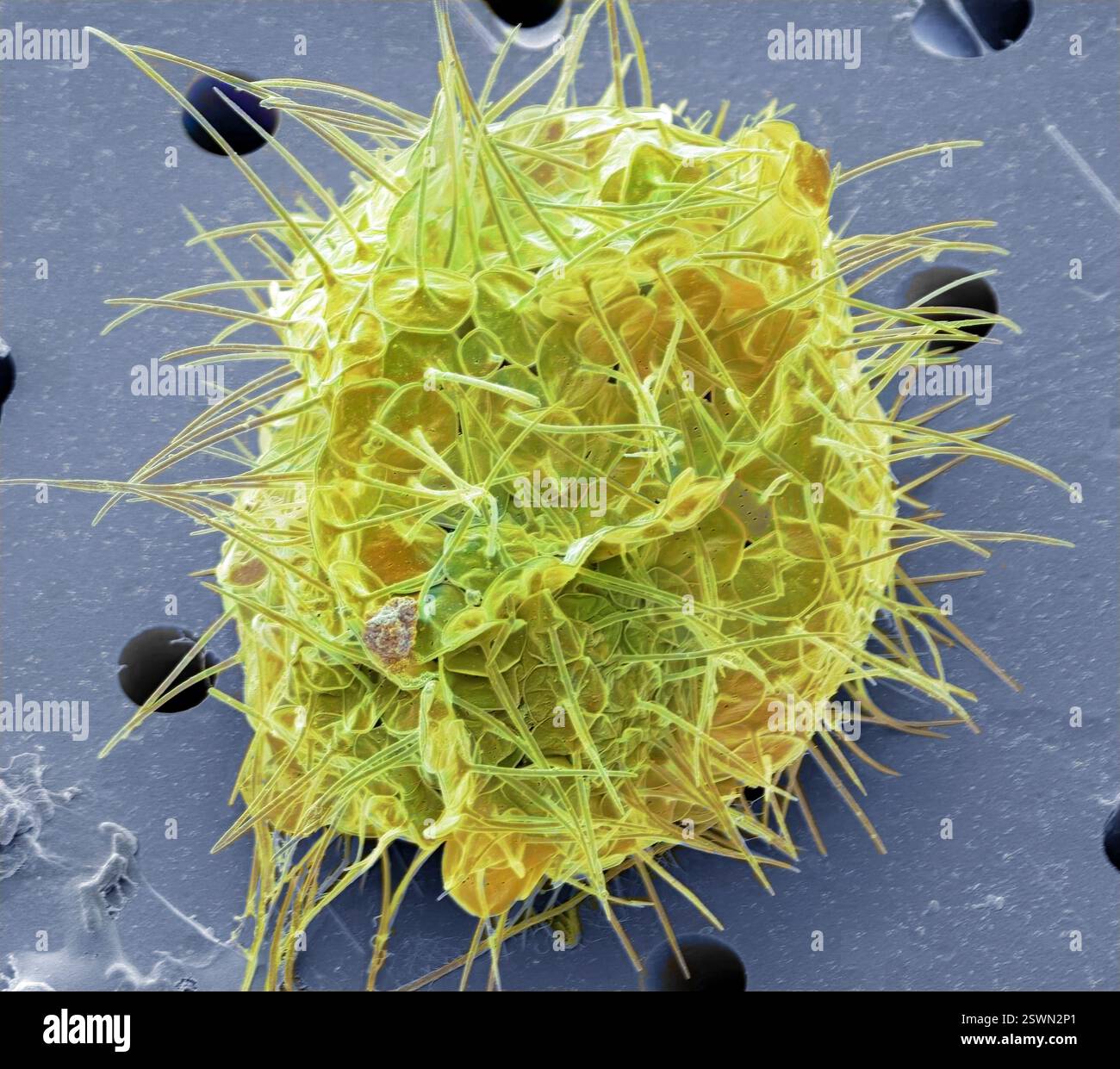 Acanthocystis. Micrographie électronique à balayage coloré (MEB) d'un héliozoaire centrohelide à écailles tangentielles et épines radiales. Ce genre Acanthocystis contient des organismes vivants unicellulaires, planctoniques ou benthoniques flottants qui sont communs en eau douce mais aussi plus rarement trouvés dans les habitats marins. La position évolutive des centrohelids n'est pas claire. Grossissement : x 2500, si imprimé 10 centimètres Banque D'Images