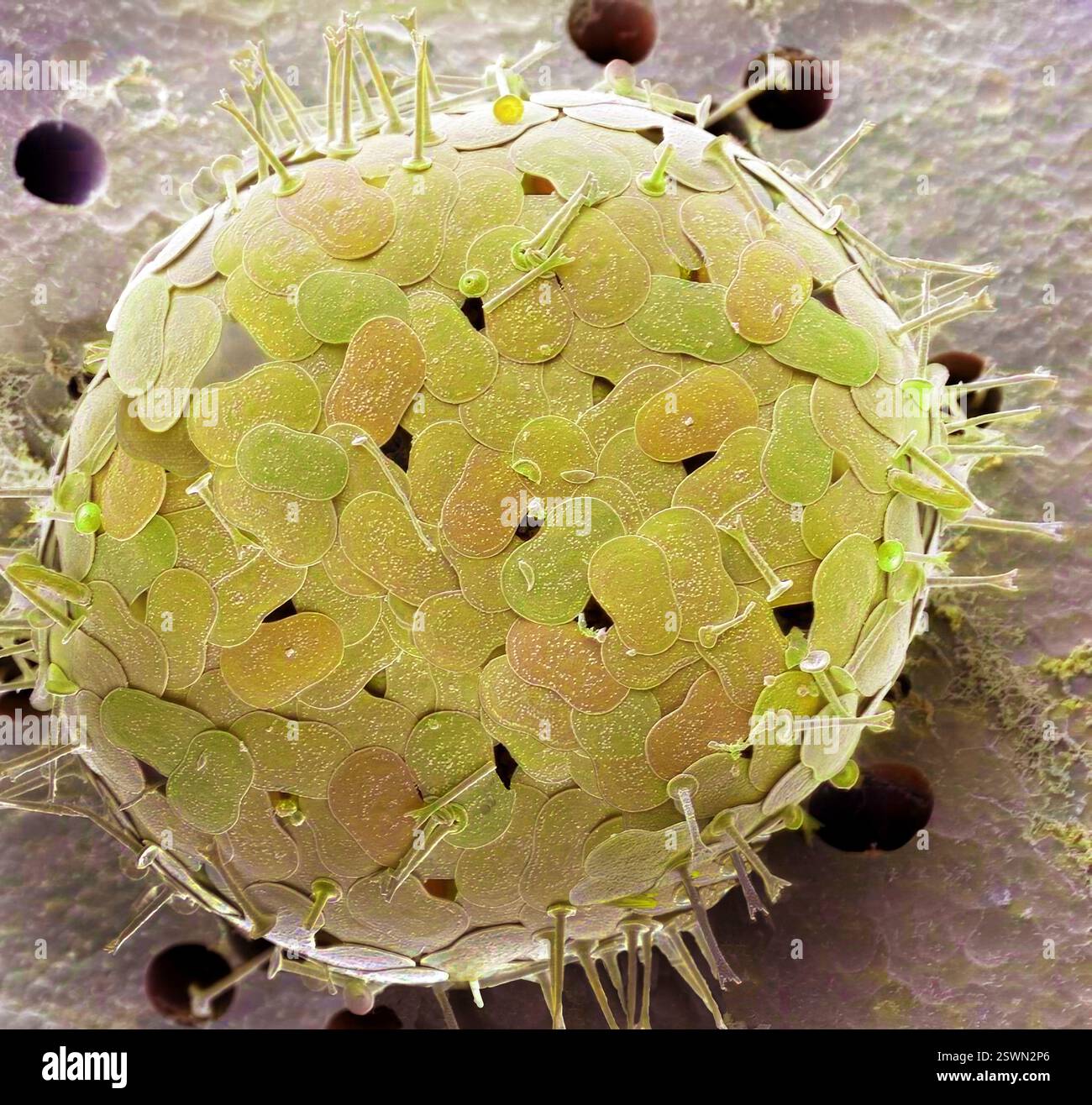 Acanthocystis. Micrographie électronique à balayage coloré (MEB) d'un héliozoaire centrohelide à écailles tangentielles et épines radiales. Ce genre Acanthocystis contient des organismes vivants unicellulaires, planctoniques ou benthoniques flottants qui sont communs en eau douce mais aussi plus rarement trouvés dans les habitats marins. La position évolutive des centrohelids n'est pas claire. Grossissement : x 2500, si imprimé 10 centimètres Banque D'Images