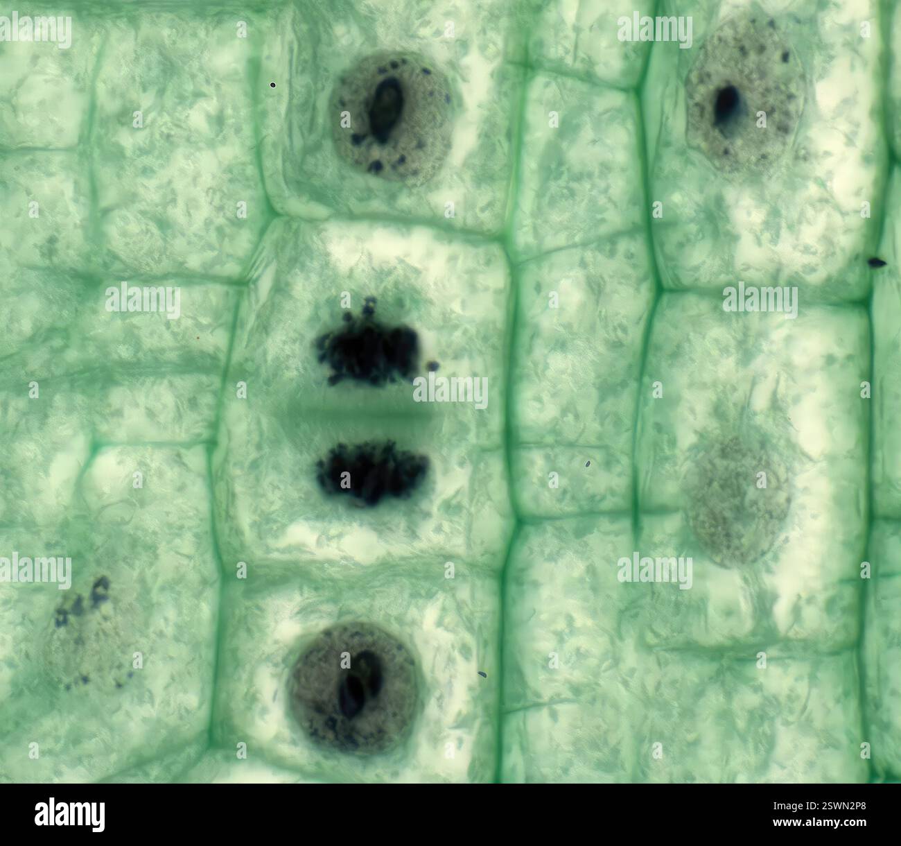 Mitose des cellules végétales. Micrographie à la lumière des cellules de la pointe des racines d'un oignon (Allium sp.) subissant une division cellulaire (mitose). Cette image montre la télophase. Grossissement : x1000 lors de l'impression de 10 centimètres de large. Banque D'Images