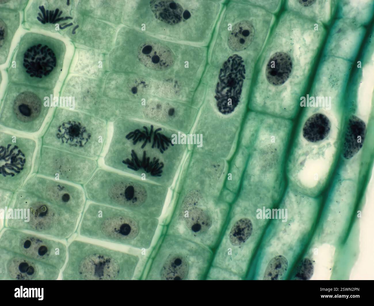 Mitose des cellules végétales. Micrographie à la lumière des cellules de la pointe des racines d'un oignon (Allium sp.) subissant une division cellulaire (mitose). Cette image montre le centre de l'anaphase et la prophase en haut à droite. Grossissement : x1000 lors de l'impression de 10 centimètres de large. Banque D'Images