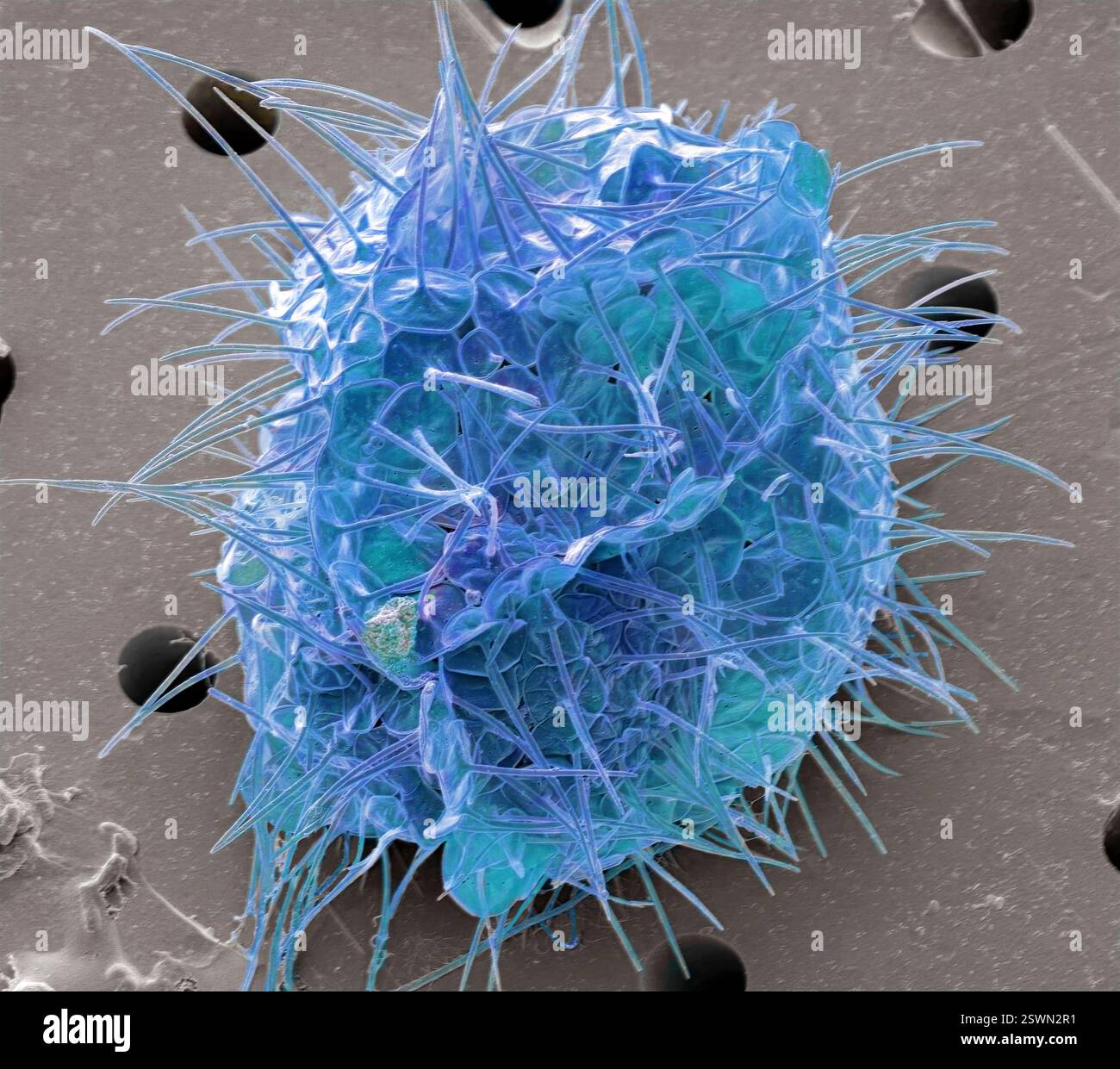 Acanthocystis. Micrographie électronique à balayage coloré (MEB) d'un héliozoaire centrohelide à écailles tangentielles et épines radiales. Ce genre Acanthocystis contient des organismes vivants unicellulaires, planctoniques ou benthoniques flottants qui sont communs en eau douce mais aussi plus rarement trouvés dans les habitats marins. La position évolutive des centrohelids n'est pas claire. Grossissement : x 2500, si imprimé 10 centimètres Banque D'Images