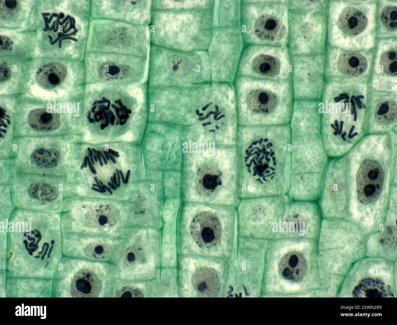 Mitose des cellules végétales. Micrographie à la lumière des cellules de la pointe des racines d'un oignon (Allium sp.) Subissant une division cellulaire (mitose) agrandissement : x1000 lorsqu'il est imprimé 10 centimètres de large. Banque D'Images