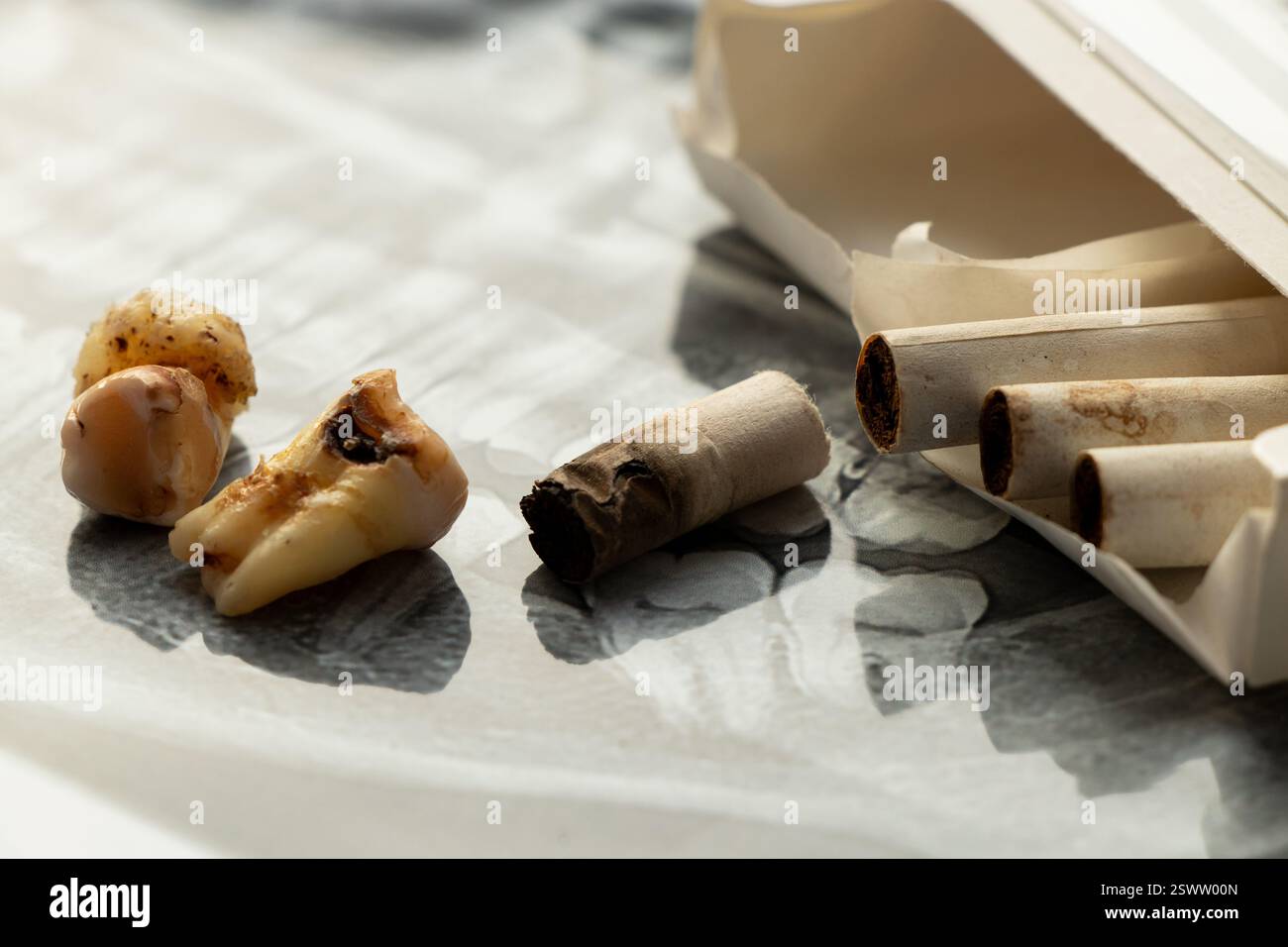 Cigarettes et une molaire noire arrachée se trouvent sur une radiographie dentaire panoramique, carie dentaire due à la nicotine, mauvaises dents d'un fumeur Banque D'Images
