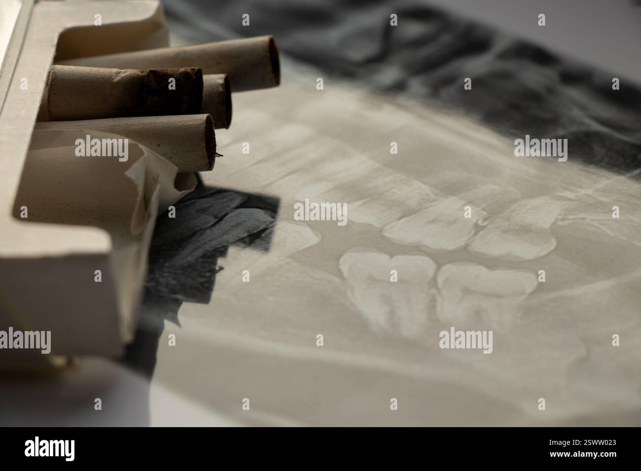 Les cigarettes reposent sur une radiographie dentaire panoramique, les caries de nicotine, les dents de mauvais fumeur Banque D'Images