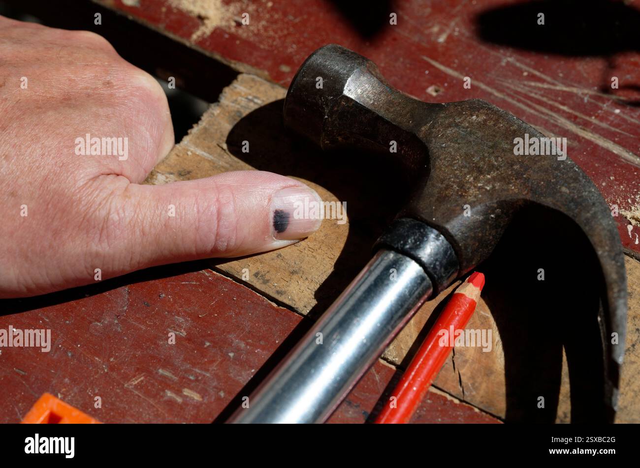 Un ongle est devenu noir à cause d'un traumatisme, dans ce cas étant frappé par un marteau. L'impact fait saigner le pouce sous l'ongle. Banque D'Images