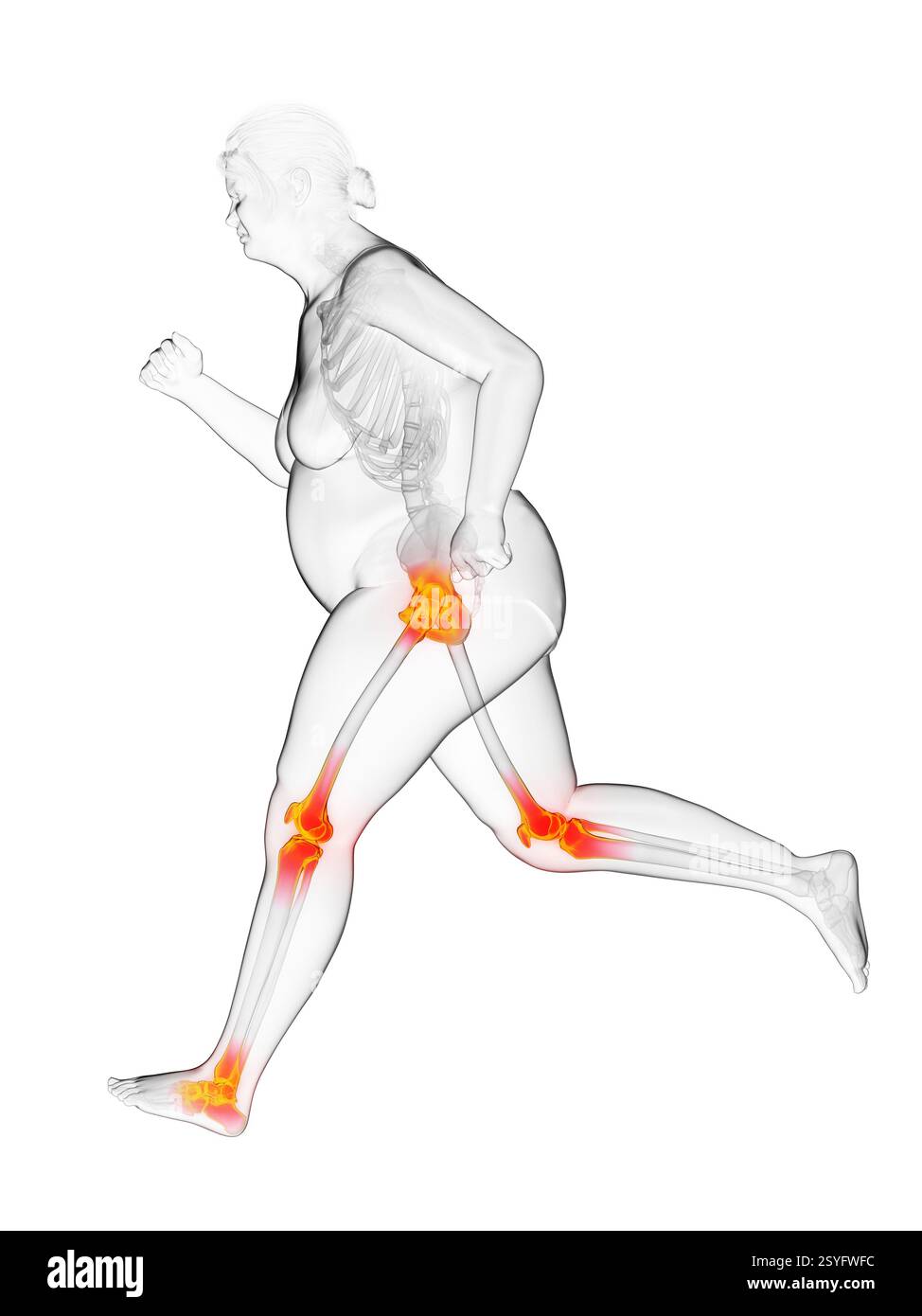 Femme en surpoids courant avec des articulations douloureuses, illustration. Banque D'Images