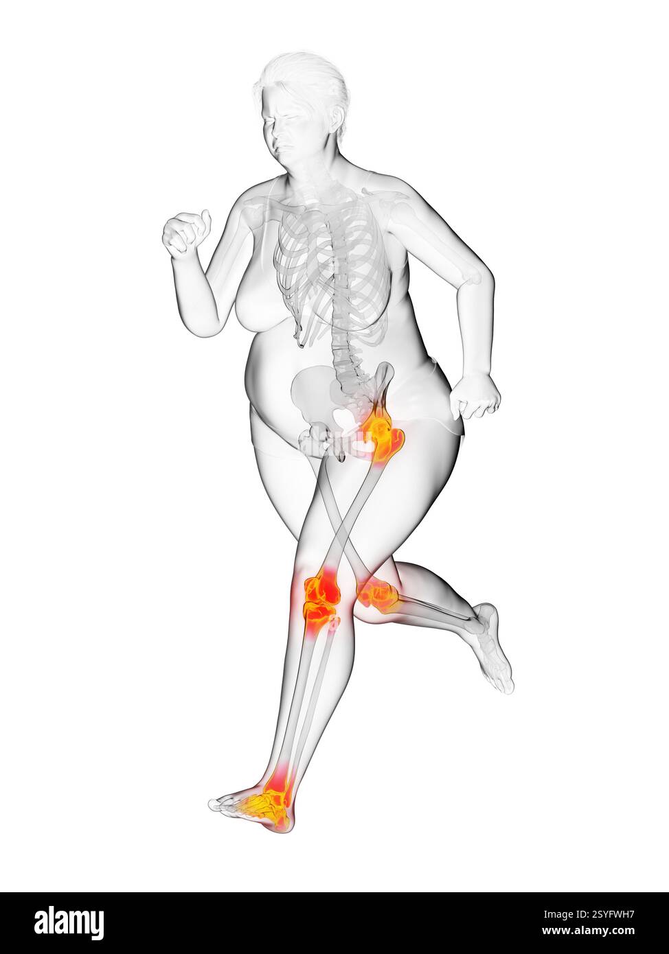Femme en surpoids courant avec des articulations douloureuses, illustration. Banque D'Images