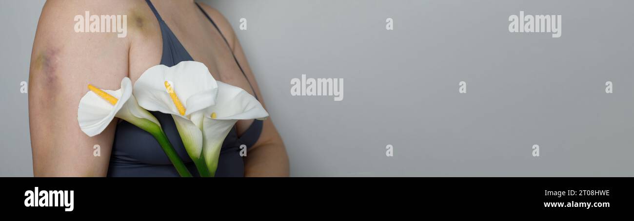 Gros plan de belle femme femme avec blessure ecchymose et fleur de lys. Problème social et concept d'arrêt de la violence Banque D'Images