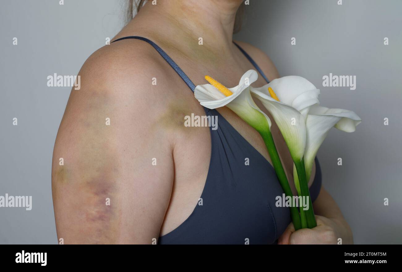 La femme est blessée, blessée, douloureuse au bras et au cou. Banque D'Images