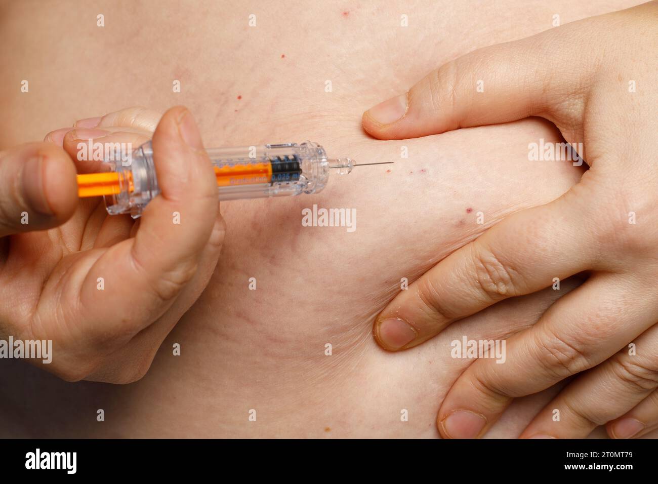 Gros plan de l'abdomen humain. La personne injecte dans l'estomac de soi avec une seringue Banque D'Images