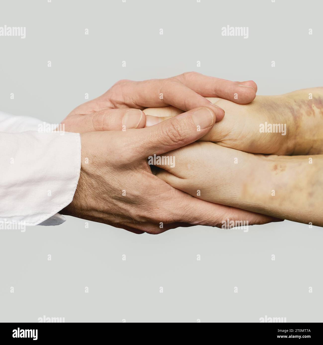 Accompagnement médico-social. Docteur nand tenant la main du patient avec des ecchymoses traumatiques Banque D'Images