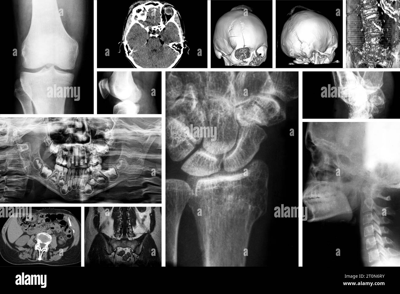 Ensemble de parties du corps radiographique telles que le genou humain, la tête, la main et les dents, groupe d'images radiologiques pour diagnostiquer différents types de maladies, squelette Banque D'Images