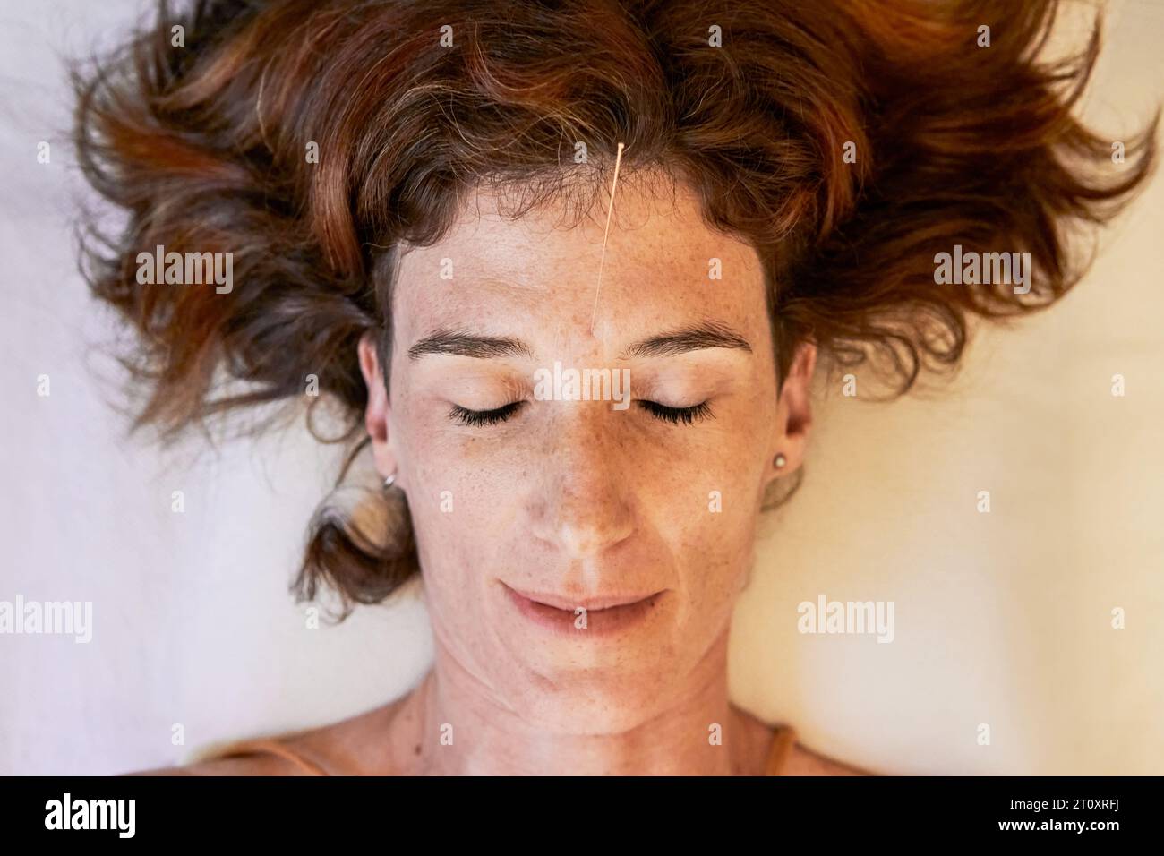 Heureuse femme de gingembre avec une aiguille d'acupuncture sur son front Banque D'Images