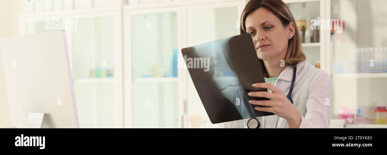 La femme étudie l'image radiographique des notes de prise de joint Banque D'Images