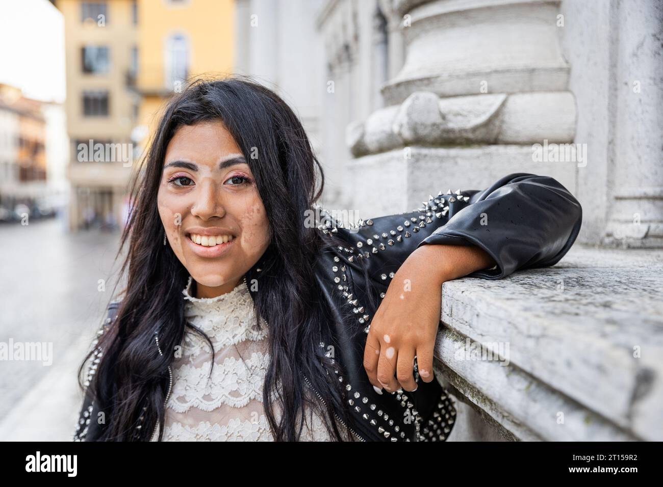 Une adolescente atteinte de vitiligo s'appuie contre le mur de la ville Banque D'Images