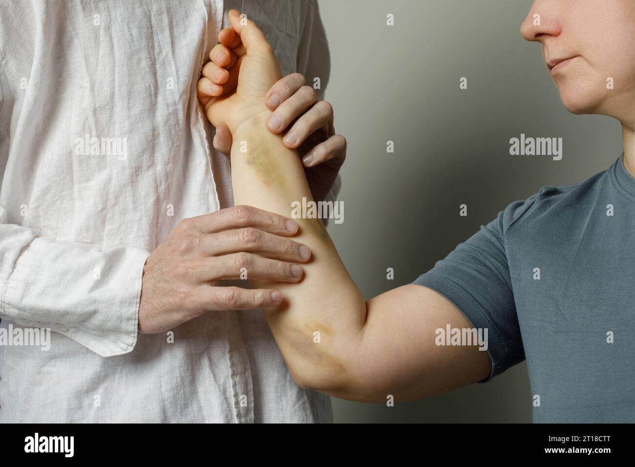 Médecin vérifiant une patiente présentant des ecchymoses à l'hôpital Banque D'Images