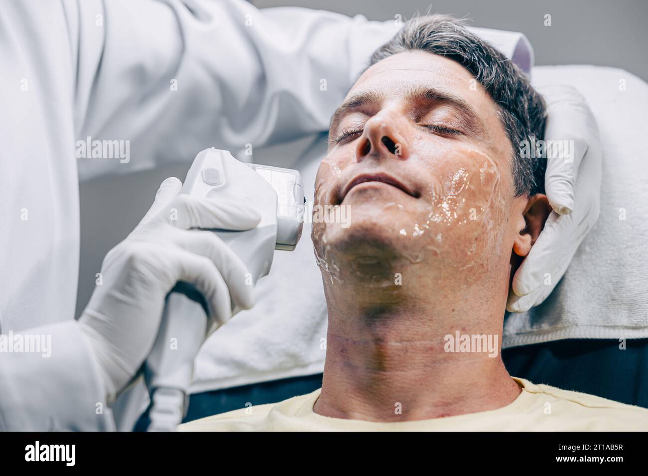 Médecin de la peau utilisant la technologie de traitement de soin du visage HIFU resurfacing avec un homme adulte pour réduire les rides et les cicatrices à la clinique anti-vieillissement Banque D'Images