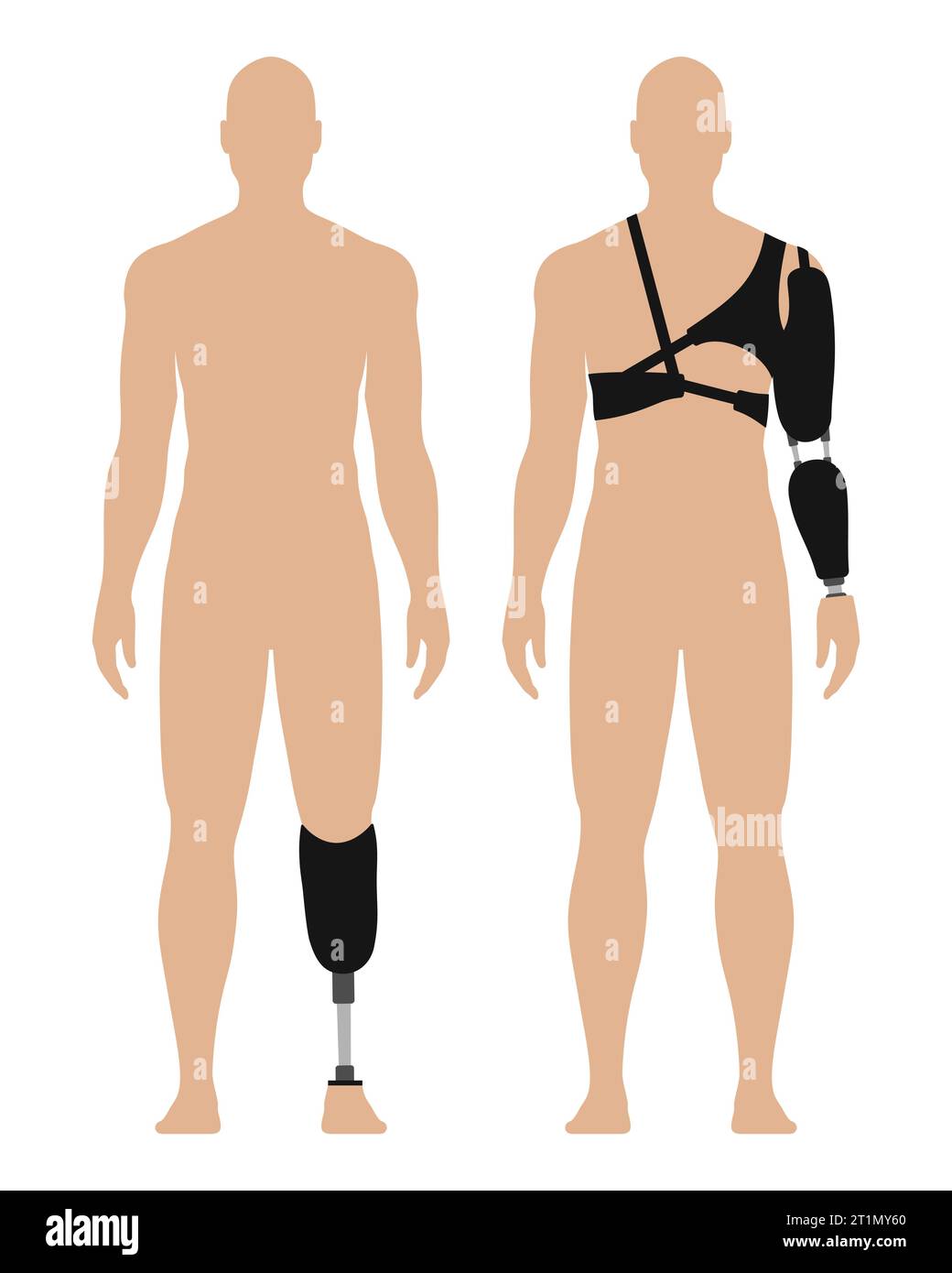 Homme avec bras prothétique et jambe, ensemble d'illustrations vectorielles médicales, isolé sur fond blanc. Illustration de Vecteur