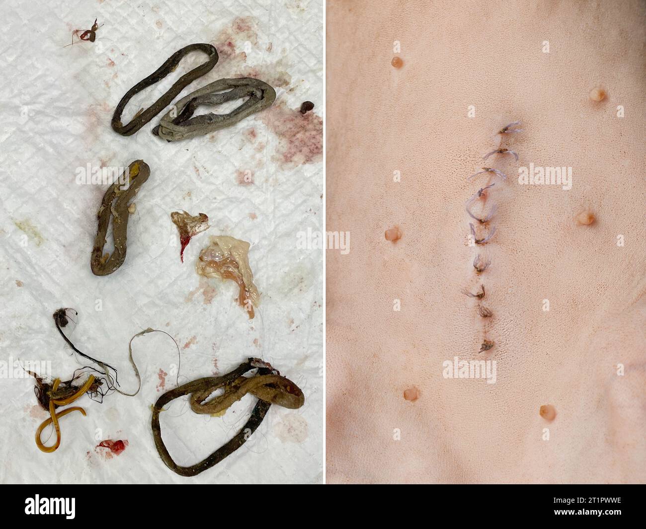 Blocage intestinal du chat. Contenu intestinal et gros plan cicatriciel de suture Banque D'Images