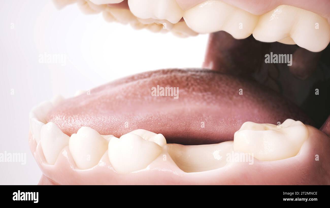Premier pas vers le sourire parfait : remplir l'écart avec un implant. Partie 3. Rendu 3D. Banque D'Images