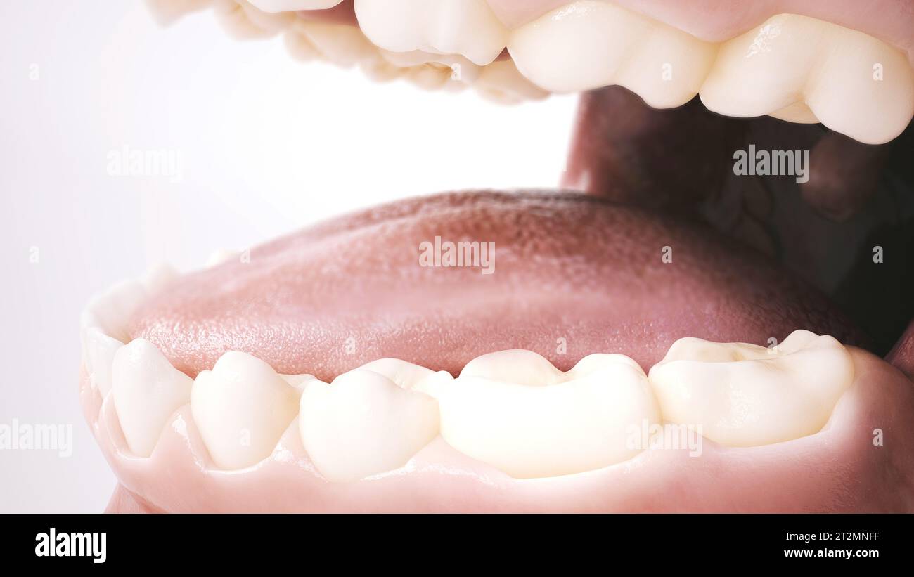 Premier pas vers le sourire parfait : remplir l'écart avec un implant. Partie 3. Rendu 3D. Banque D'Images