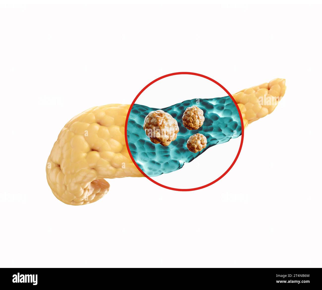 Anatomie de l'illustration réaliste 3d de l'organe interne humain - pancréas. Radiographie du pancréas humain à la recherche d'une maladie cancéreuse Banque D'Images