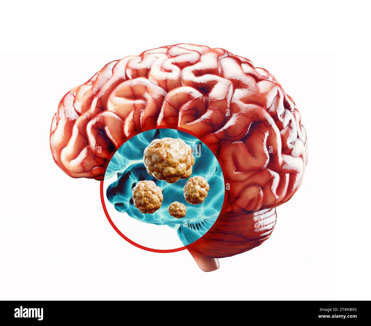 Anatomie de l'illustration réaliste 3d de l'organe interne humain - cerveau. Radiographie du cerveau humain à la recherche d'un cancer Banque D'Images
