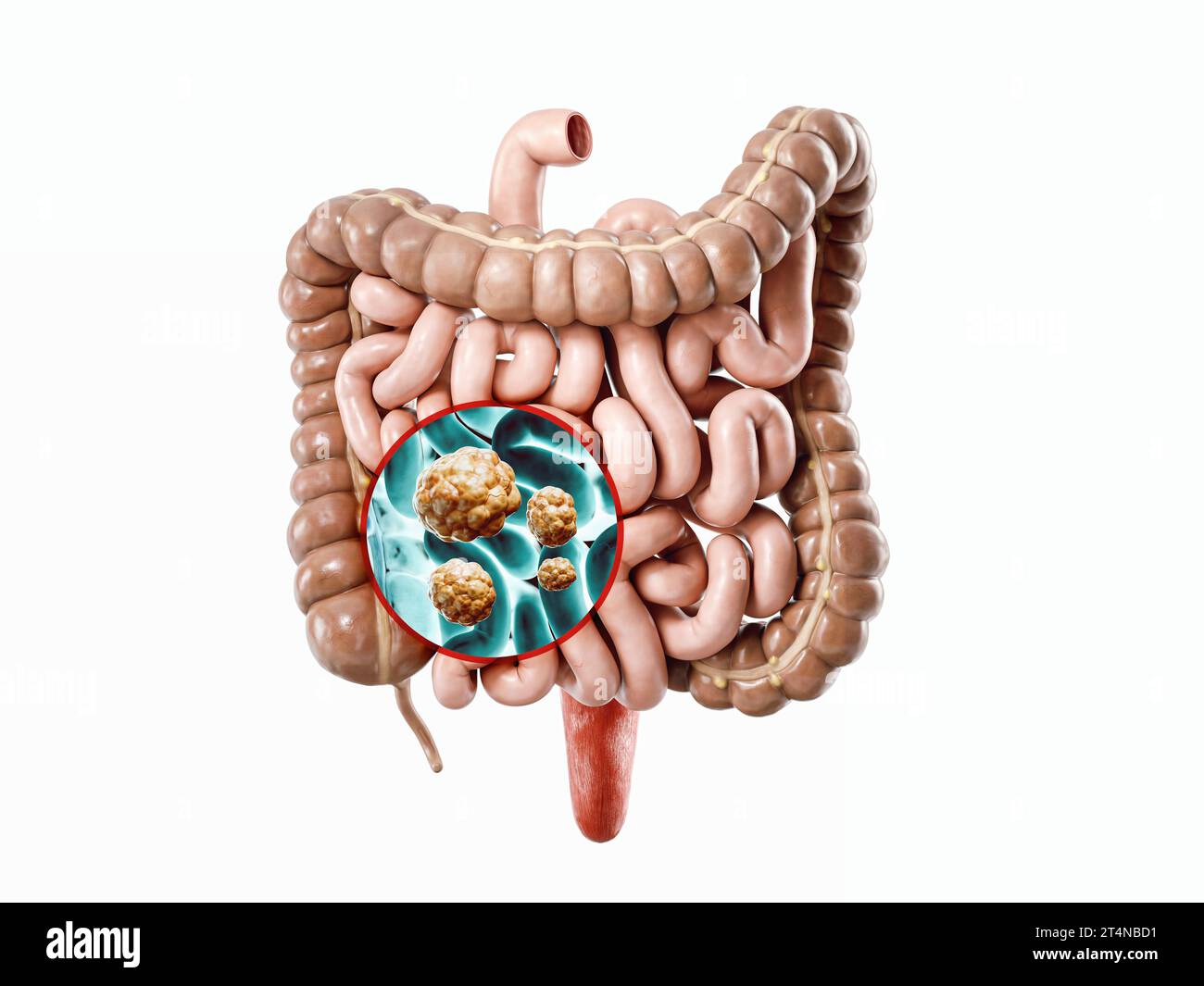 Anatomie de l'illustration réaliste 3d de l'organe interne humain - intestin. Radiographie de l'intestin humain pour cancer Banque D'Images