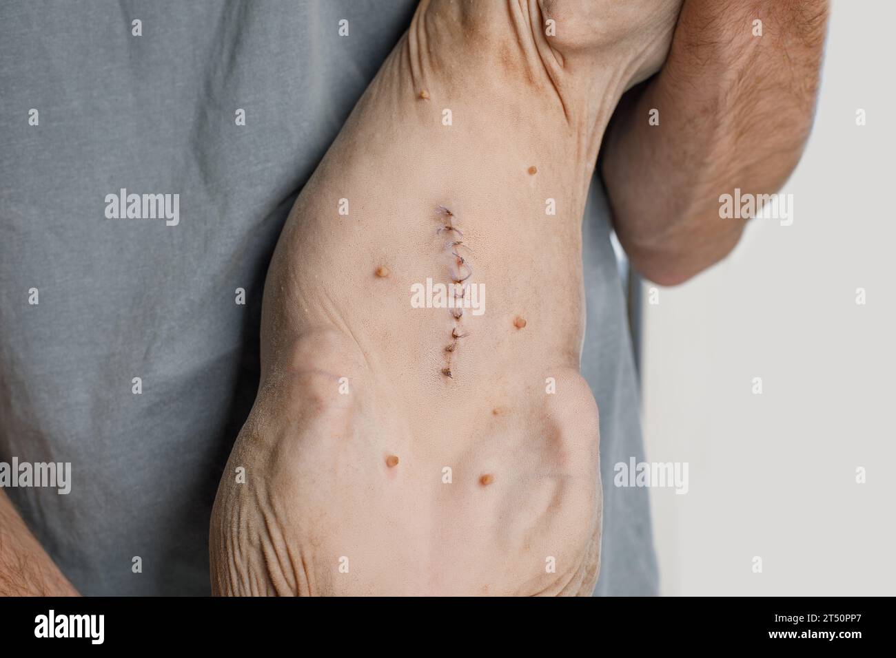 Cicatrice de suture après chirurgie ou stérilisation. Gros plan de l'estomac de chat Banque D'Images