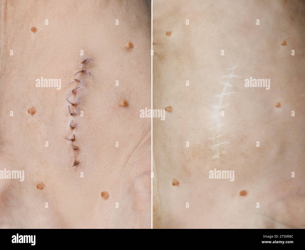 Suture chirurgicale après chirurgie ou stérilisation et cicatrice après guérison. Gros plan sur la peau de chat Banque D'Images