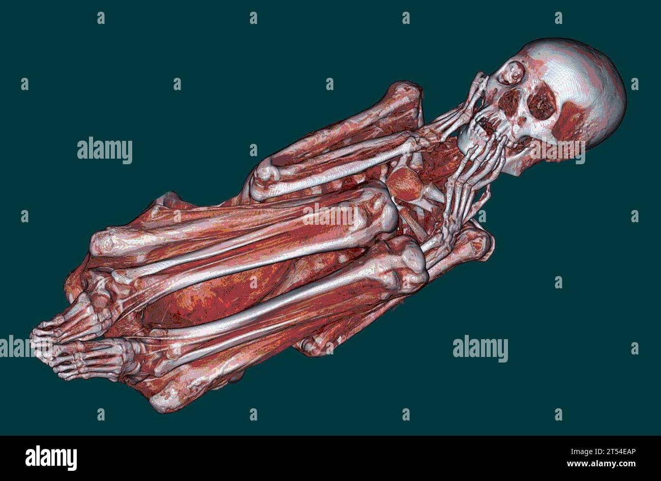 CT scan, Naval Medical Center San Diego, Navy, momie péruvienne, San Diego Museum of Man, U.S. Navy Banque D'Images