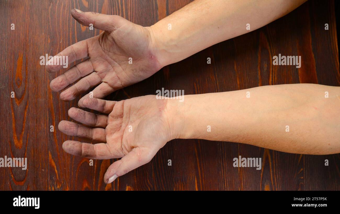 mains masculines allongées paumes vers le haut sur un plateau en bois foncé, mains d'un homme adulte blanc travaillant avec la peau ridée sur les doigts et assombrissement de la peau Banque D'Images