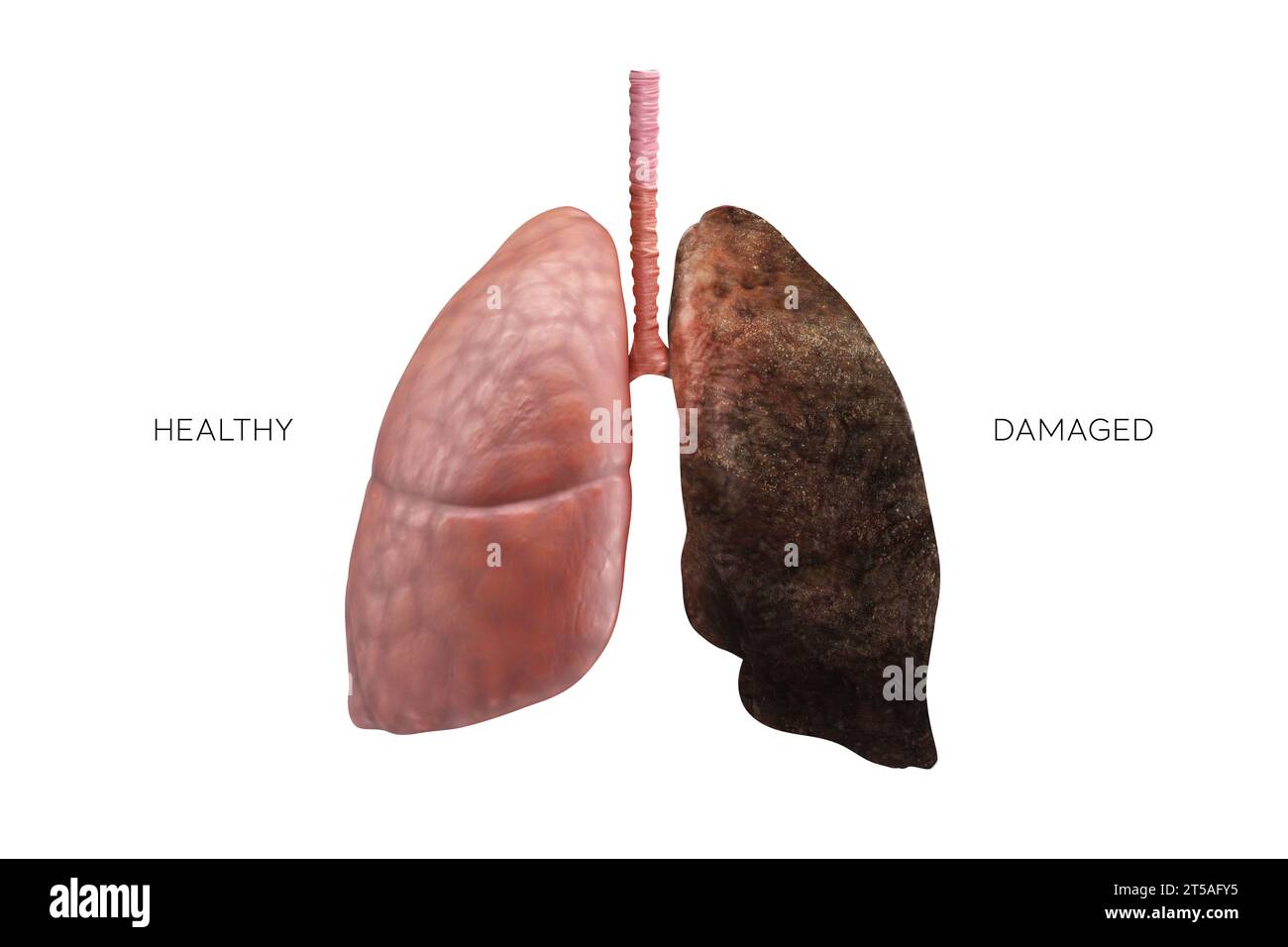 Poumons illustration 3D - partie de Human Organic. Compression saine et endommagée. Banque D'Images