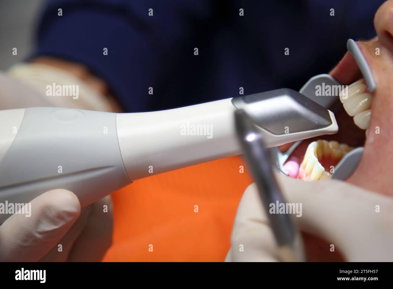 Cabinet dentaire. Scanner dentaire panoramique 3D. Le lieu de travail du dentiste. Jeune femme visitant le dentiste à la clinique. Dentiste masculin avec patient en clinique. Banque D'Images