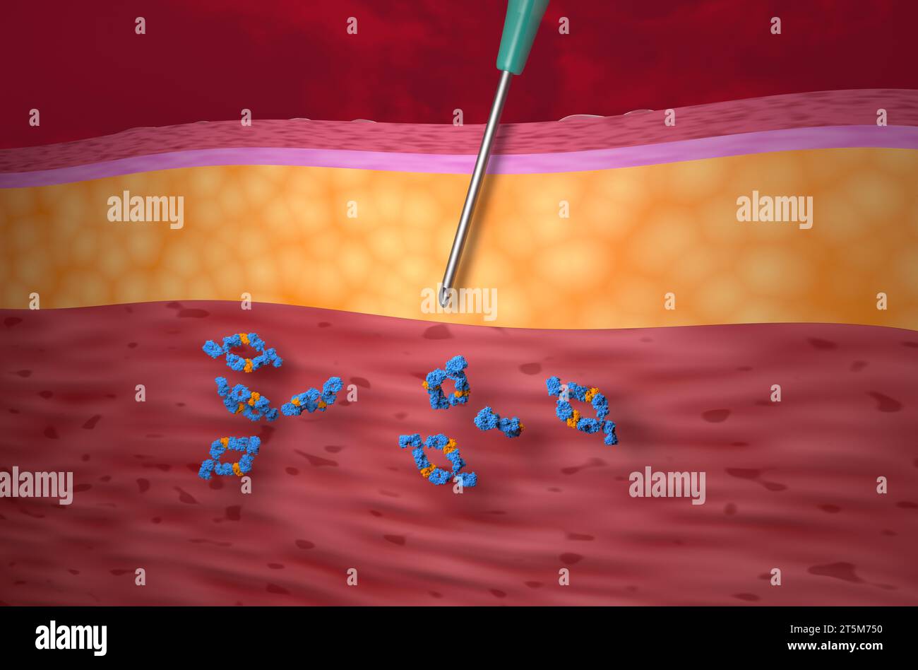 Traitement par anticorps monoclonaux (adalimumab) - vue en gros plan illustration 3D. Banque D'Images