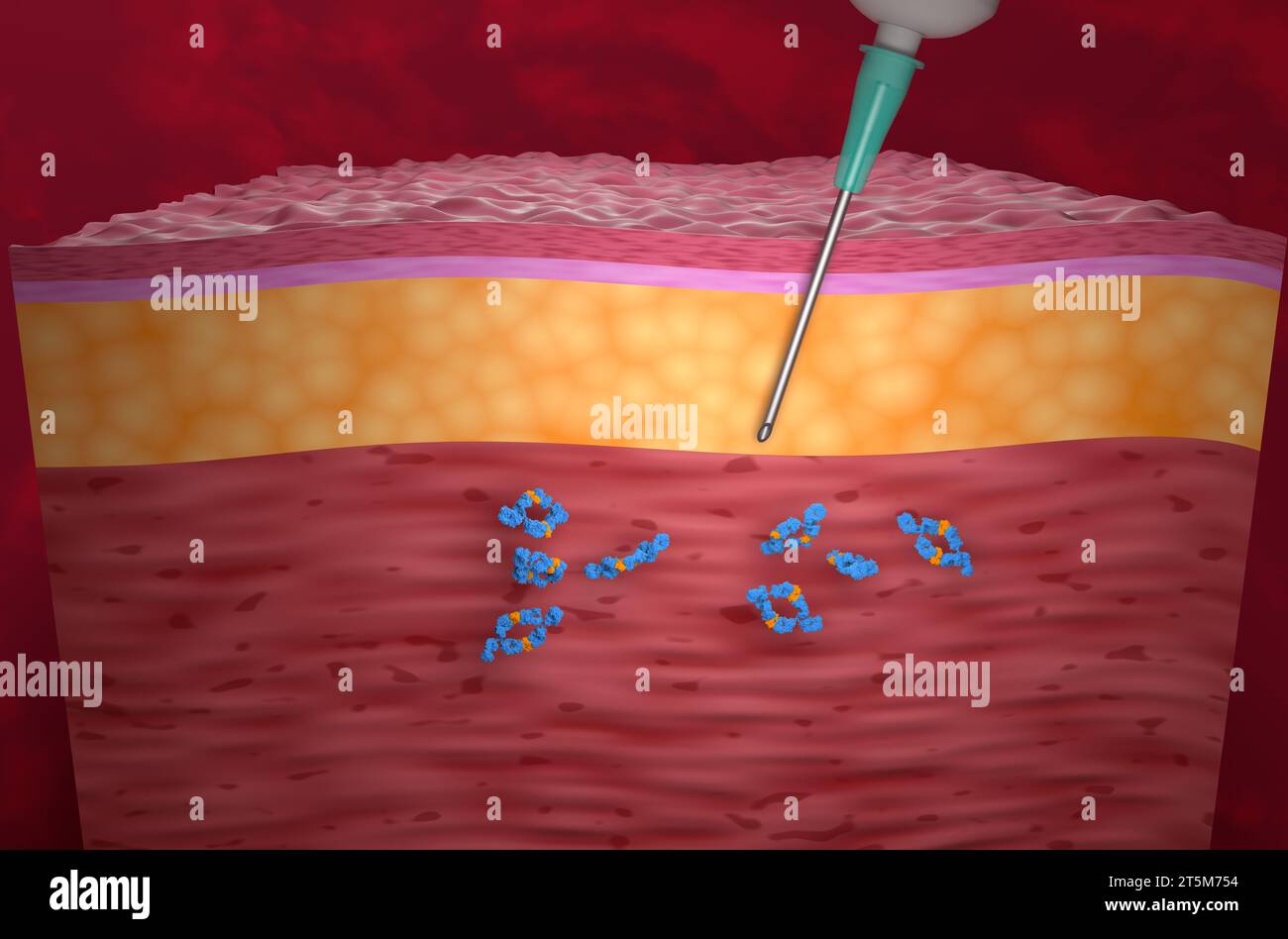 Traitement par anticorps monoclonaux (adalimumab) - vue isométrique, illustration 3D. Banque D'Images