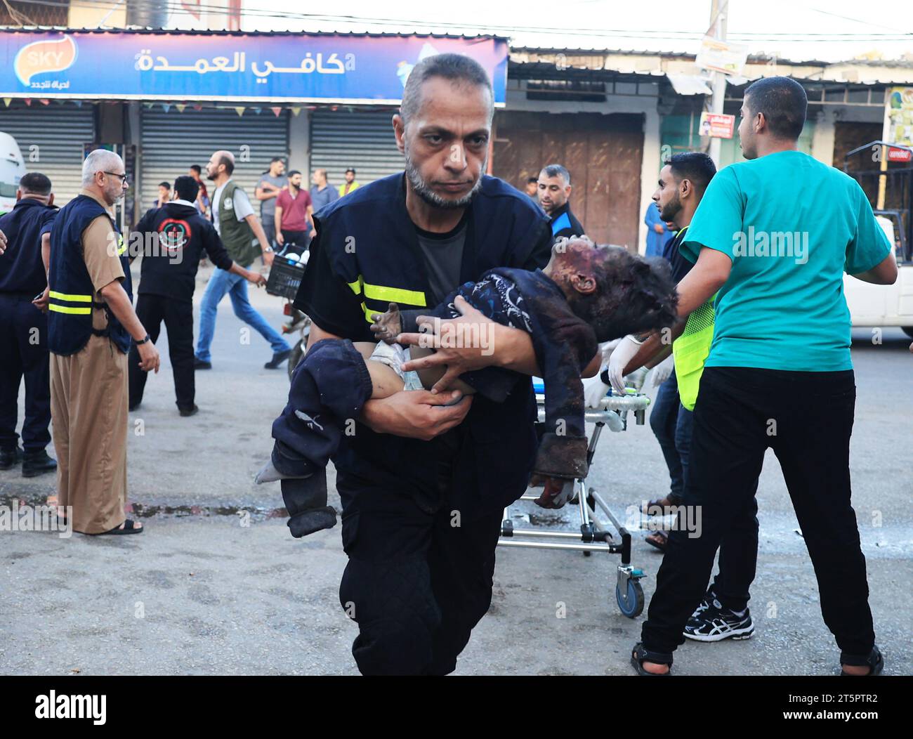Rafah, Gaza. 06 novembre 2023. Un enfant palestinien blessé est emmené à l’hôpital suite à une