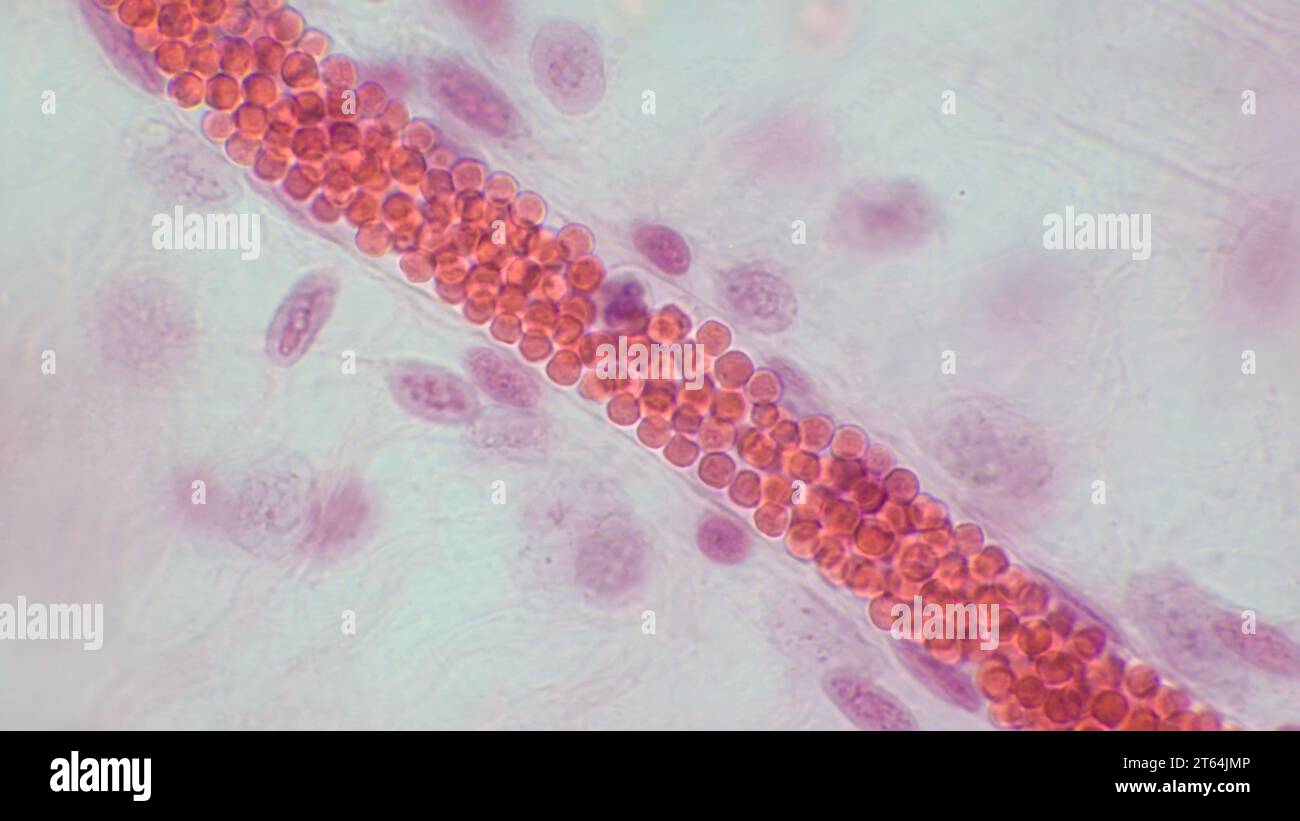 Microcirculation capillaire. Vaisseau sanguin avec globules rouges, micrographie légère. Coloration de l'hématoxyline en fin d'éosine. Banque D'Images