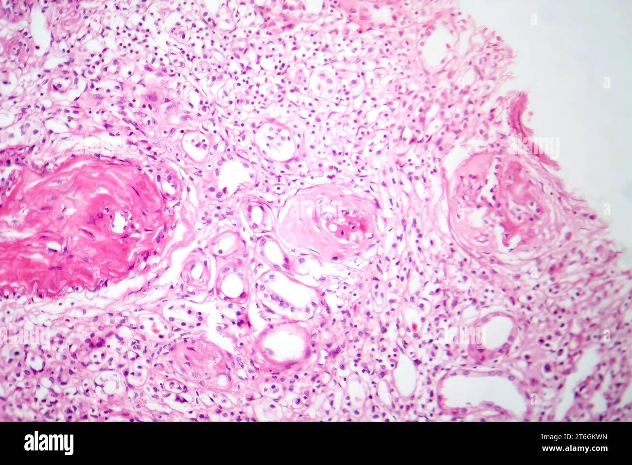 Tissu Rénal Kidney and nephron Banque de photographies et d’images à haute ...