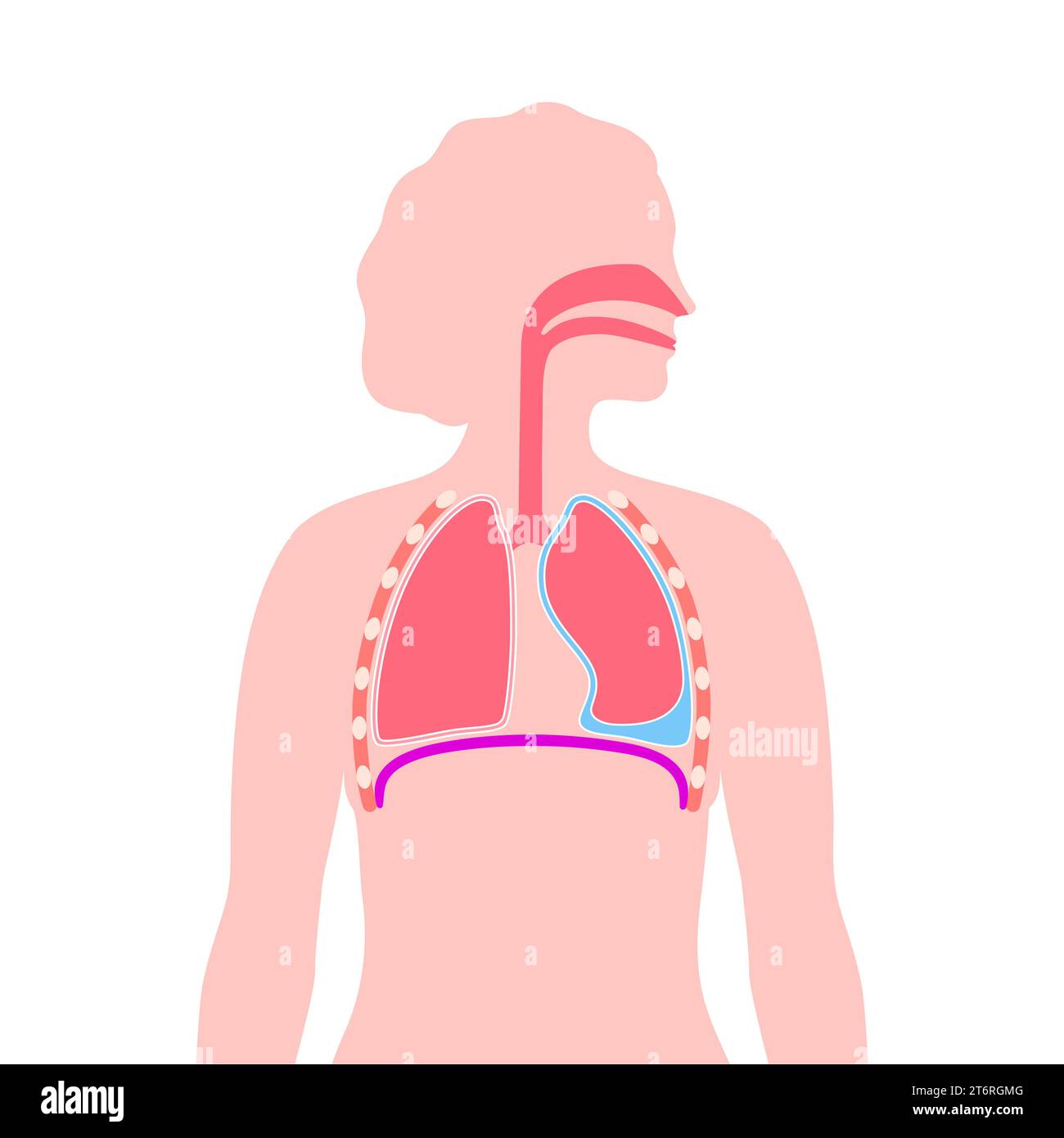 Épanchement pleural, illustration Banque D'Images