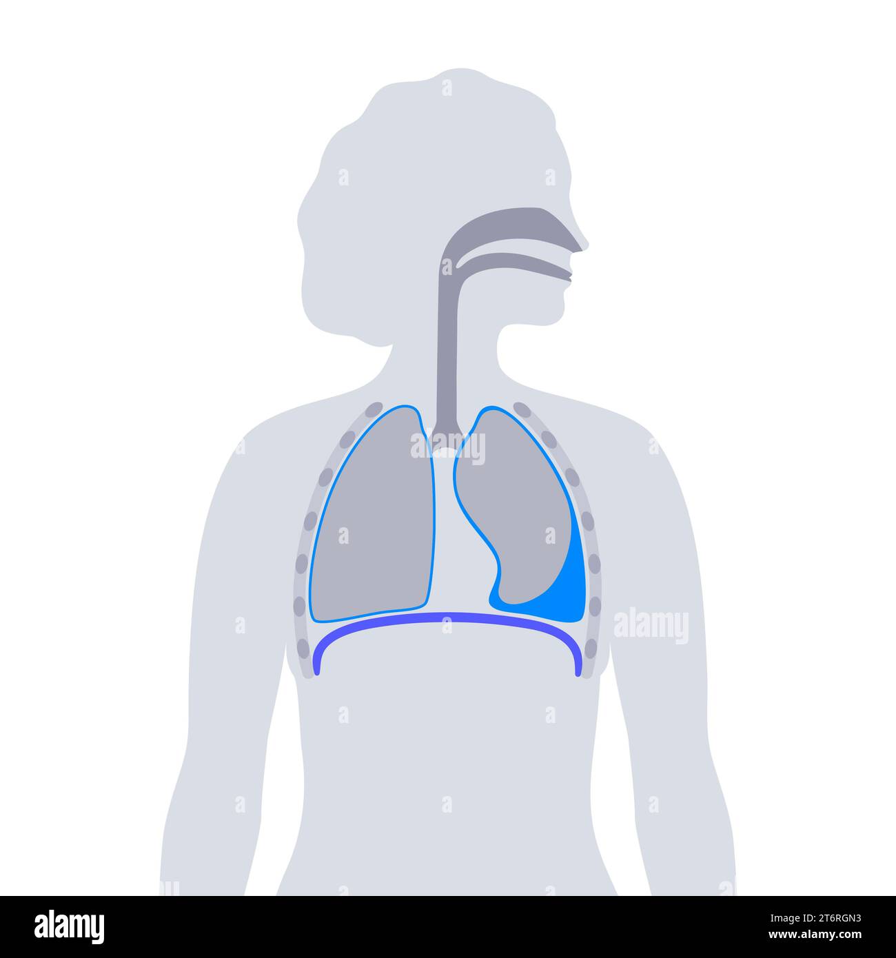 Épanchement pleural, illustration Banque D'Images